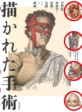 【バーゲンブック】描かれた手術 19世紀外科学の原理と実際およびその挿画