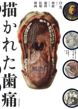 【バーゲンブック】描かれた歯痛 白と黒、および神経からなる歯科医療挿画